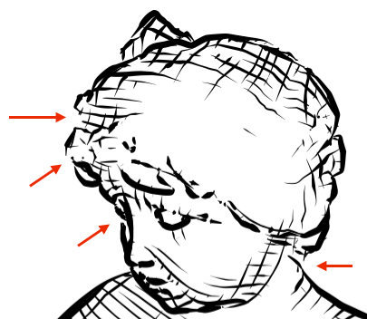 Occluding Contour Breakthroughs, Part 1: A Surprisingly Hard Problem